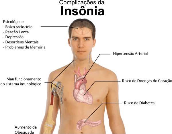 Imagem ilustrativa sobre consequências da insônia para a saúde física e mental