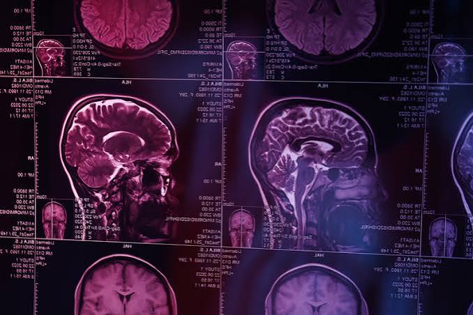 Representação de regiões e circuitos cerebrais envolvidos nas respostas de medo e pânico.